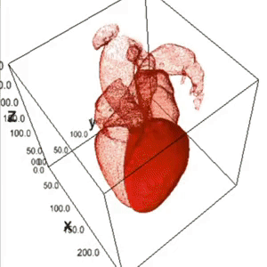 AI driven heart segmentation from CT scans